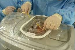 Transplantation d’organes : le Conseil fédéral veut renforcer la sécurité des patients